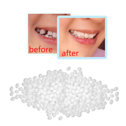 Solid Dental Glue for Denture Repair